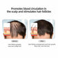 Peigne de massage électrique EveVista™